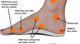 collapsed arch pain